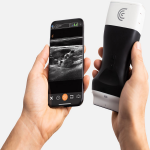 Superior Ultrasound Imaging Wireless Scanner