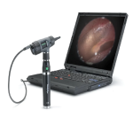 Digital MacroView® Otoscope