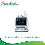 Portable Ultrasound Price in Bangladesh